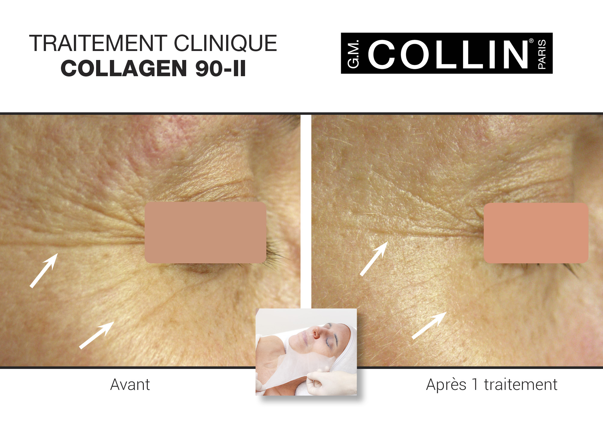 Joindre Julie Latreille esthéticienne | Clinique d'esthétique Növa | soins corps et visage à Québec