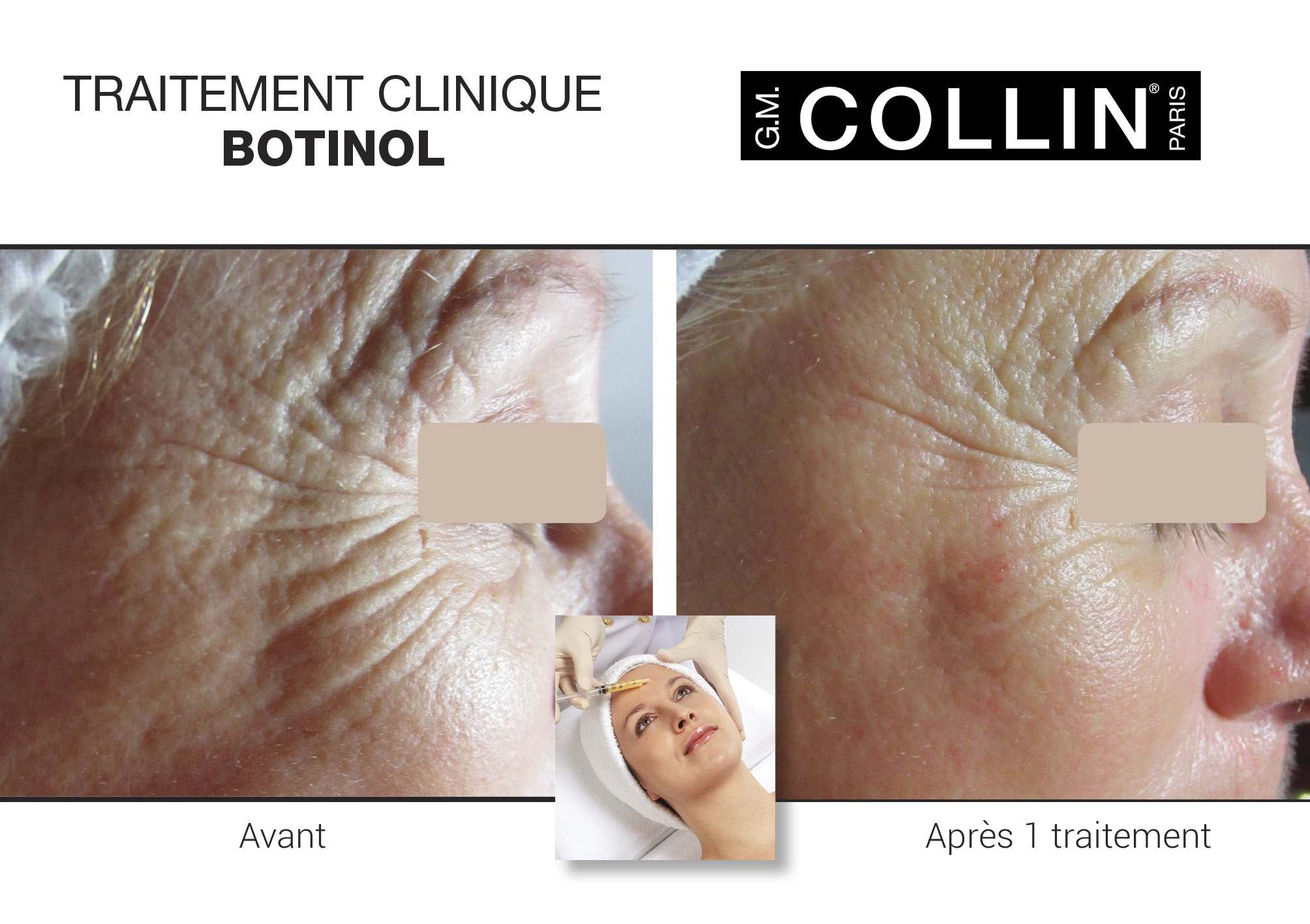 Joindre Julie Latreille esthéticienne | Clinique d'esthétique Növa | soins corps et visage à Québec