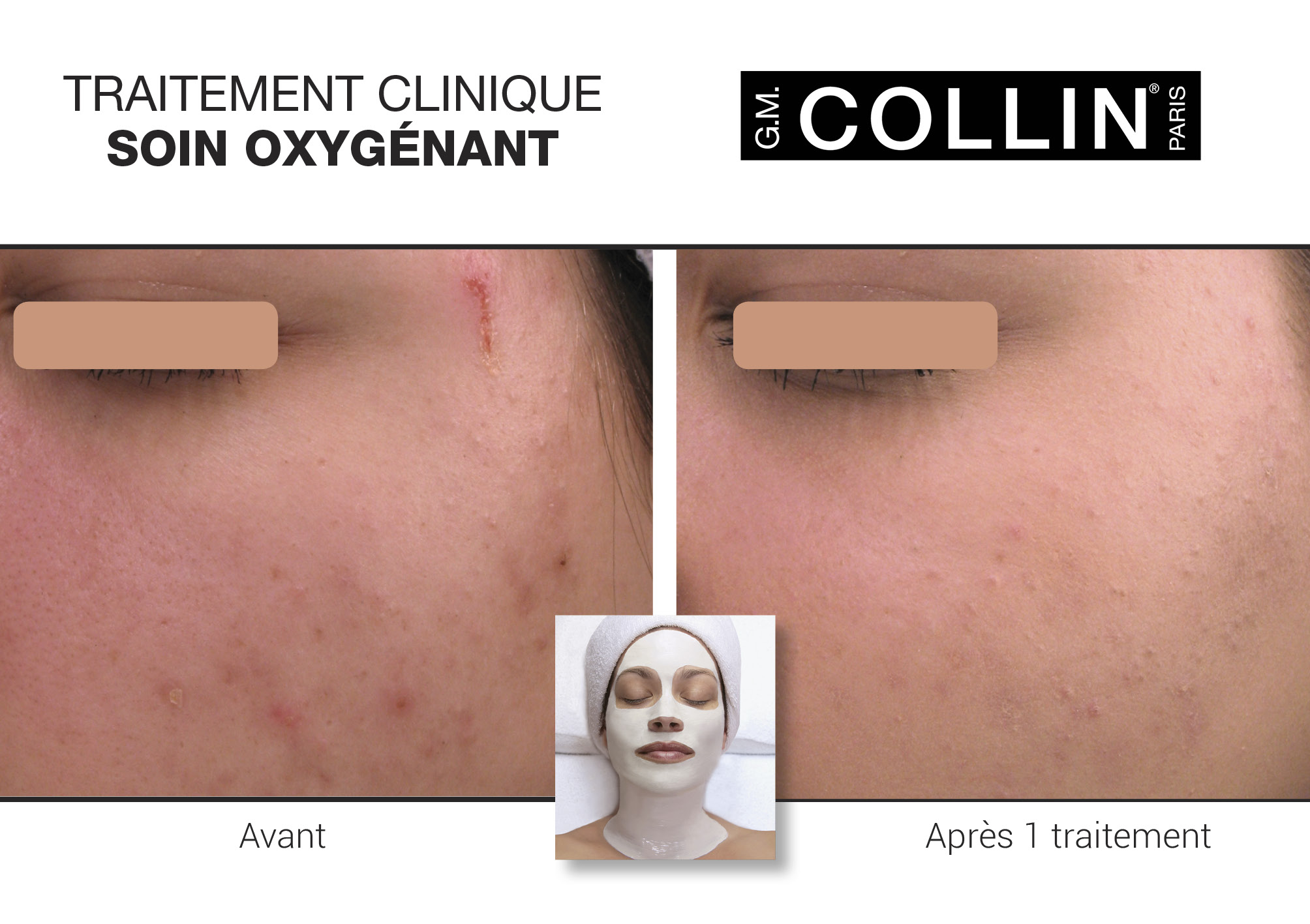 Joindre Julie Latreille esthéticienne | Clinique d'esthétique Növa | soins corps et visage à Québec