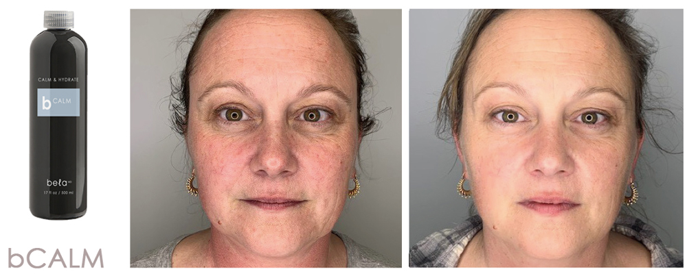 Joindre Julie Latreille esthéticienne | Clinique d'esthétique Növa | soins corps et visage à Québec