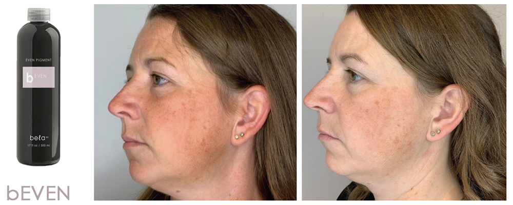 Joindre Julie Latreille esthéticienne | Clinique d'esthétique Növa | soins corps et visage à Québec