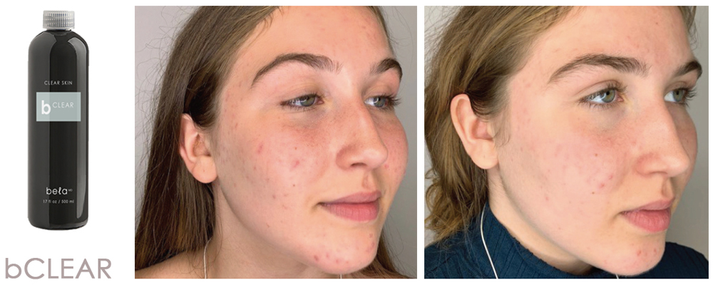 Joindre Julie Latreille esthéticienne | Clinique d'esthétique Növa | soins corps et visage à Québec