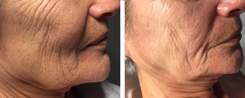 Joindre Julie Latreille esthéticienne | Clinique d'esthétique Növa | soins corps et visage à Québec