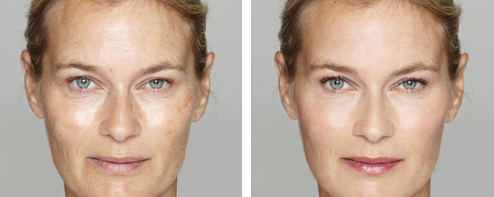 Joindre Julie Latreille esthéticienne | Clinique d'esthétique Növa | soins corps et visage à Québec