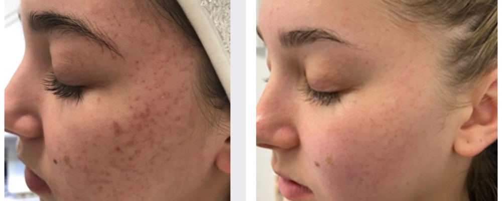 Joindre Julie Latreille esthéticienne | Clinique d'esthétique Növa | soins corps et visage à Québec