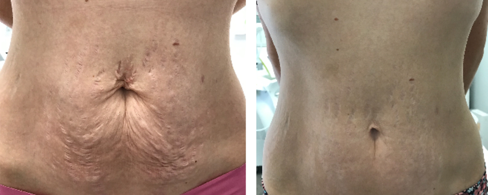 Joindre Julie Latreille esthéticienne | Clinique d'esthétique Nova | soins corps et visage à Québec